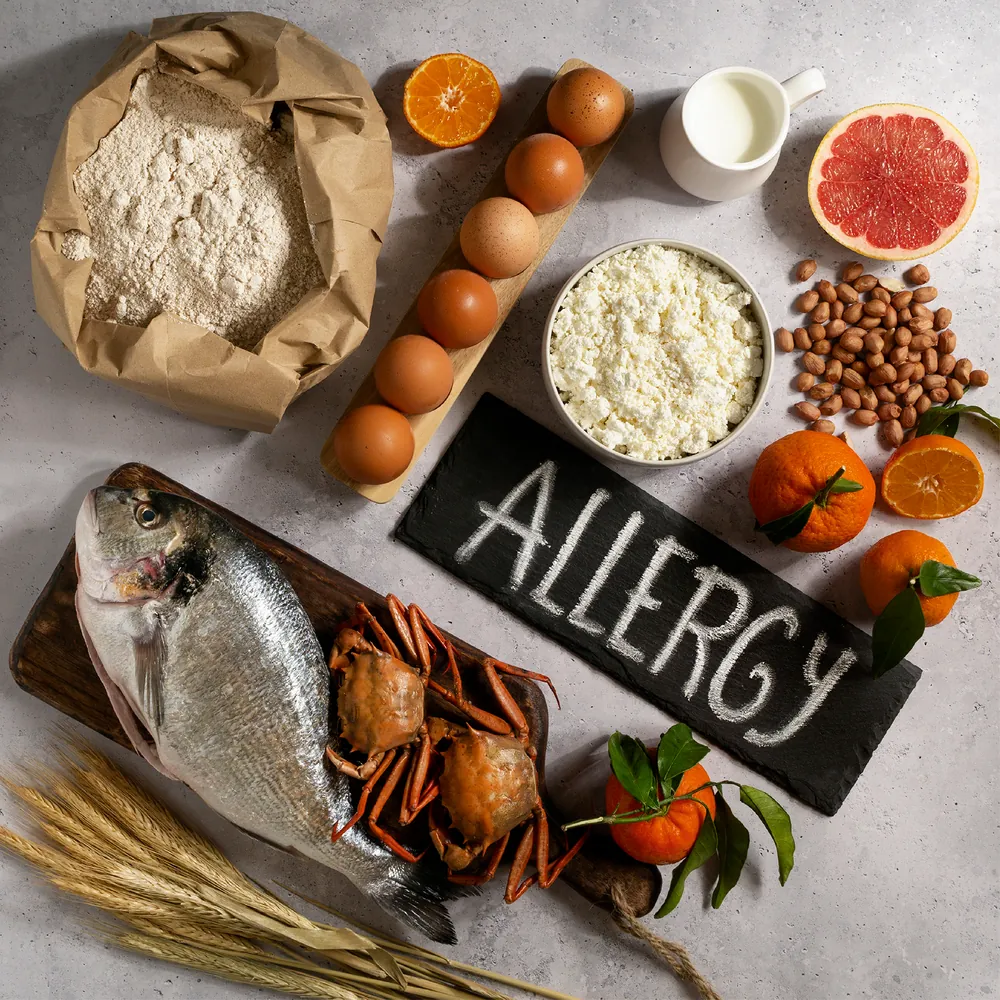 Allergies Profile - Food test at Vesta Care in Dubai