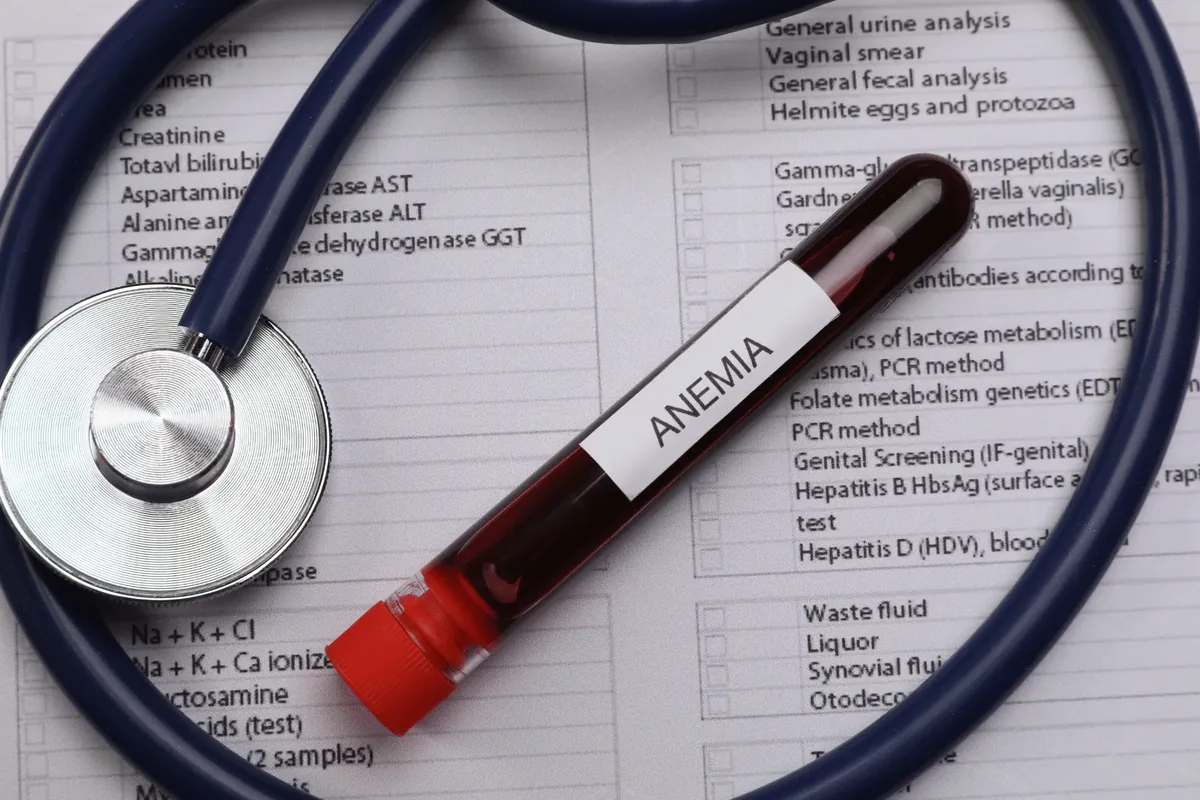 Blood collection tube labelled Anemia resting on a stethoscope over a laboratory test request form, for an anemia test at home in Dubai