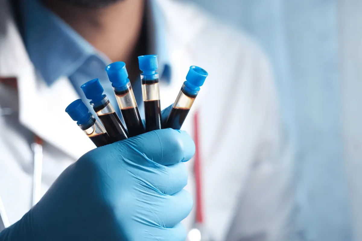 Gloved hand of a laboratory professional holding five blood collection tubes, for a CBC (complete blood count) test at home in Dubai