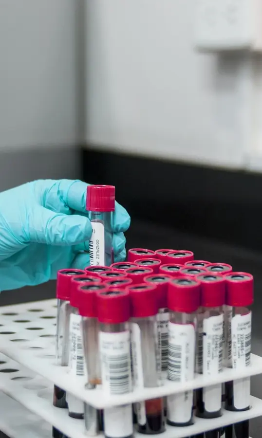 Tray of labelled blood collection tubes