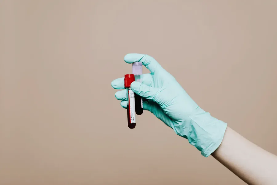 Gloved clinician's hand holding a capped collection tube of dark venous blood ready for HbA1c analysis