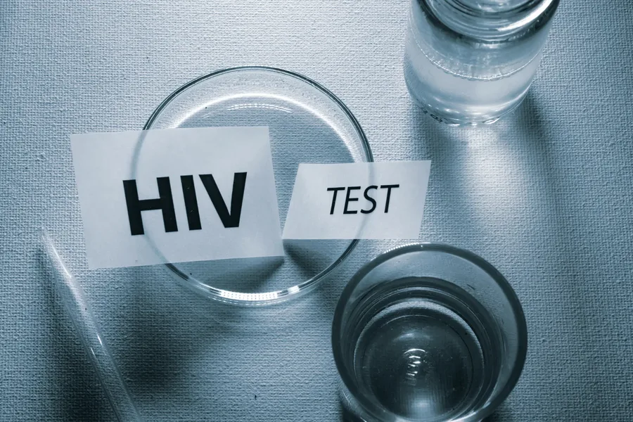 Laboratory glassware beside paper labels reading HIV TEST, representing discreet and confidential HIV testing at home in Dubai