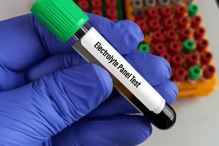 Gloved hand holding a blood sample tube labelled Electrolyte Panel Test at an accredited Dubai laboratory