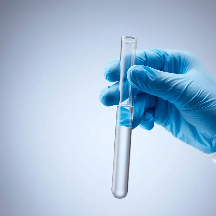 A gloved hand holding an empty blood collection tube of the kind used to draw the venous sample for a standard electrolyte test at home in Dubai