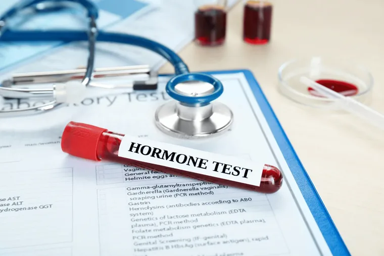 A gloved laboratory hand holding a fertility hormone blood sample tube beside a completed lab request form in Dubai