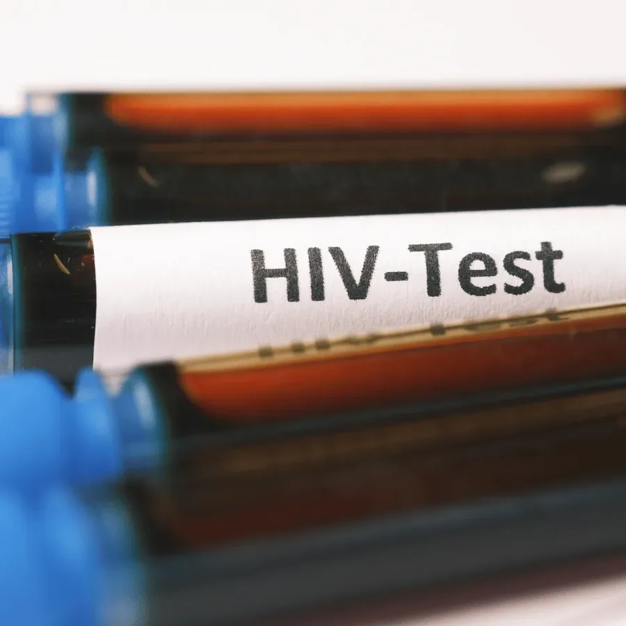 A blood collection tube labelled HIV-Test, the sample type a DHA-licensed Vesta Care nurse collects during an HIV test at home in Dubai