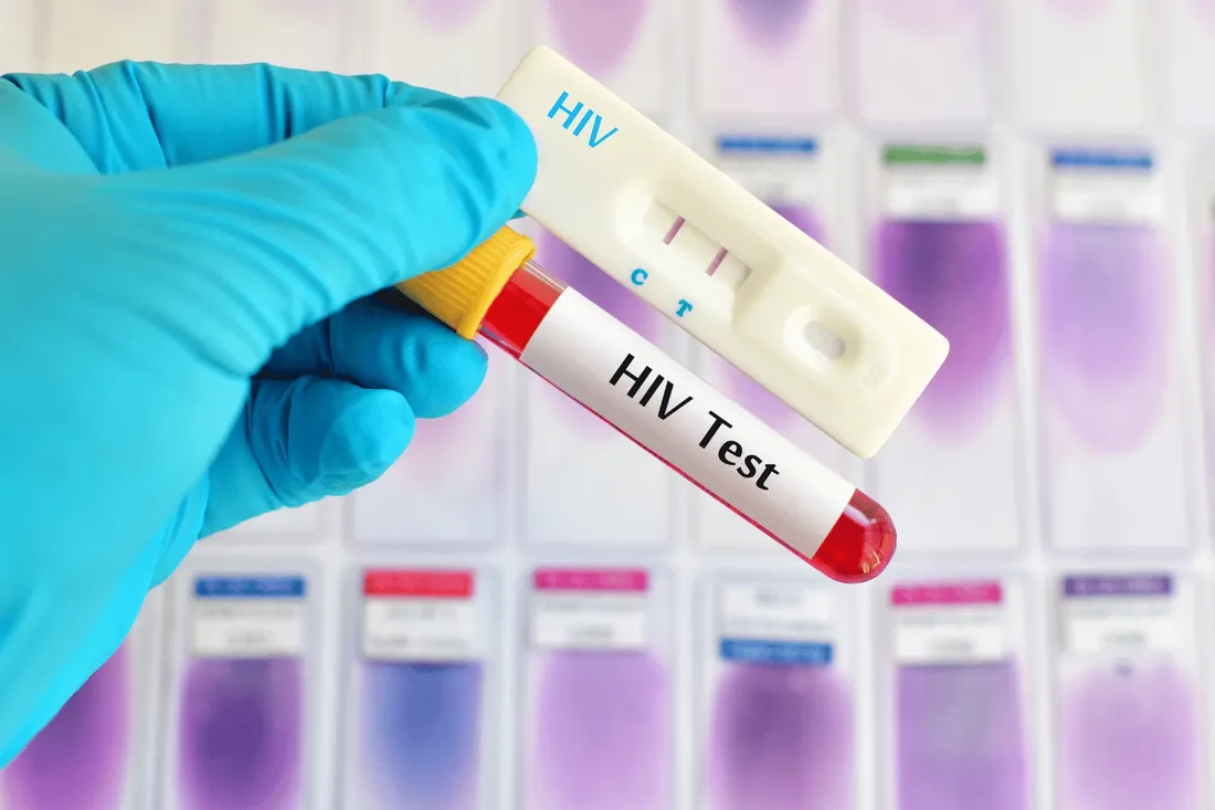 A gloved laboratory professional at Vesta Care's accredited partner laboratory in Dubai holding a labelled HIV blood sample collected during a home visit