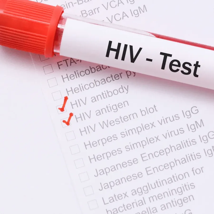 A blood sample tube labelled HIV - Test resting on a laboratory request form with the HIV antibody and HIV antigen boxes ticked, representing a confidential HIV test in Dubai