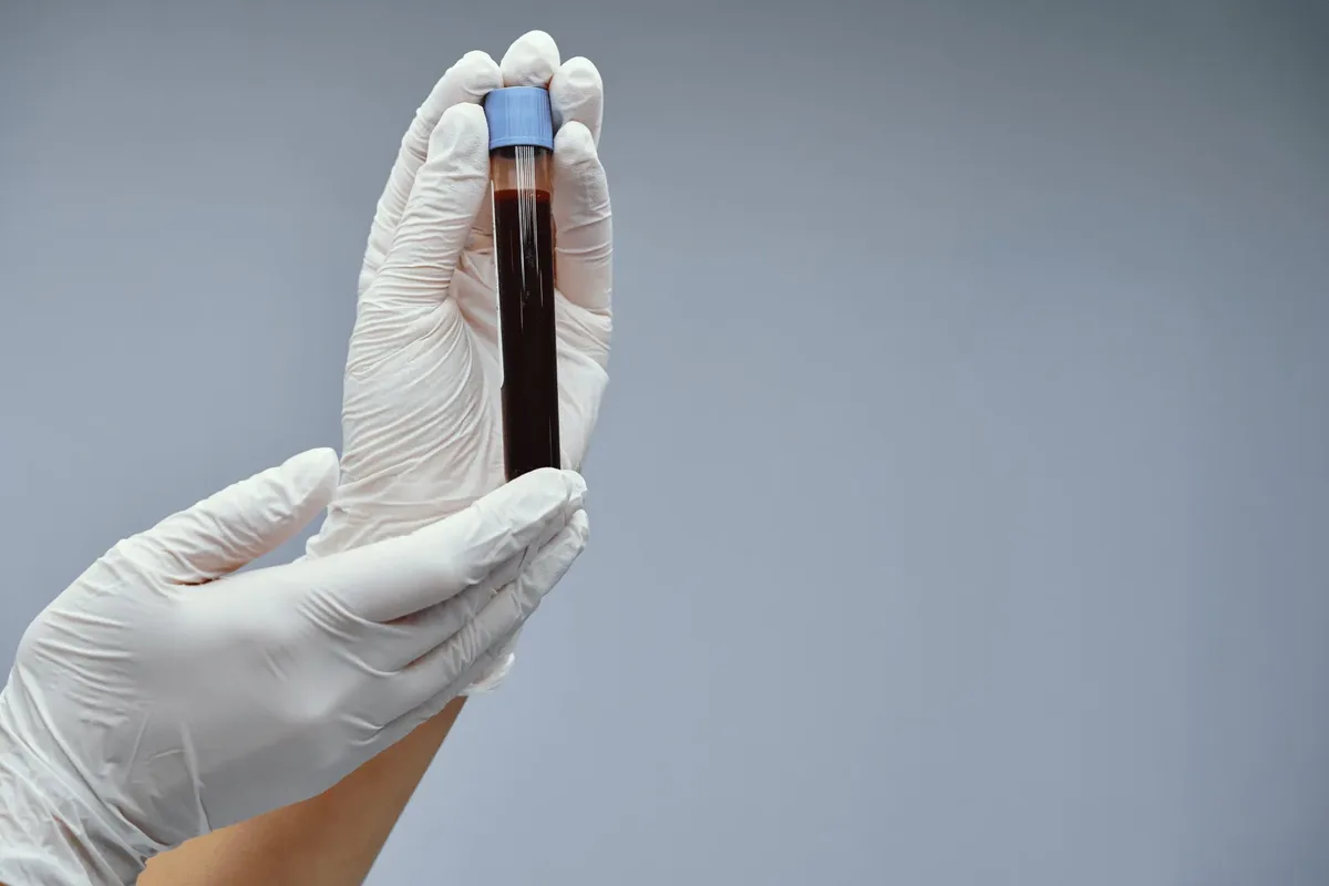 Gloved hand holding a capped blood collection tube for a male and female hormones test at home in Dubai