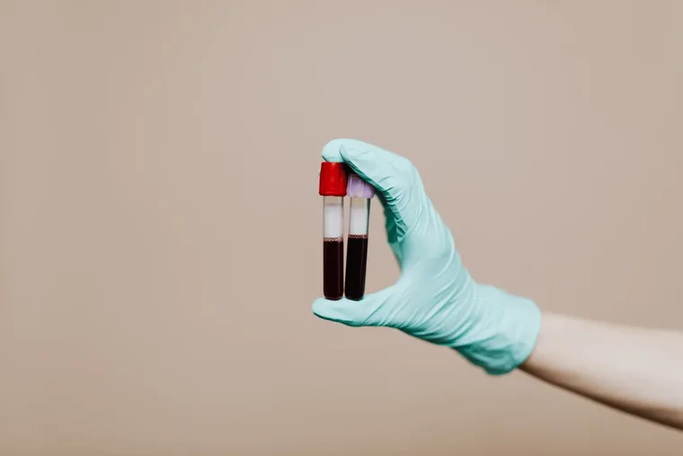 Gloved hand holding a blood collection tube drawn for a lipid profile test at home in Dubai