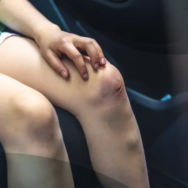 DHA-licensed doctor treating a minor injury and dressing a wound at home in Dubai