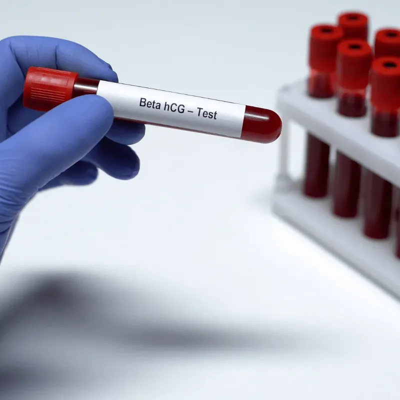 A beta hCG pregnancy blood sample tube prepared for laboratory analysis in Dubai