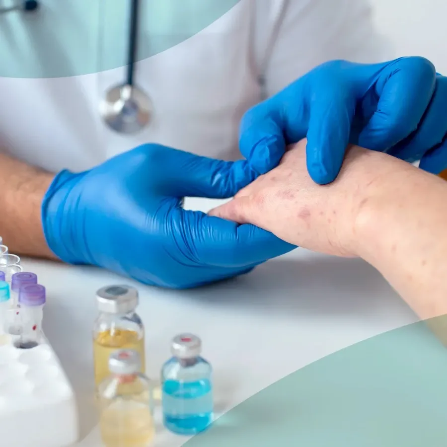 A DHA-licensed clinician in gloves examining a patient's syphilis rash beside blood sample vials, representing confidential syphilis testing at home in Dubai with Vesta Care