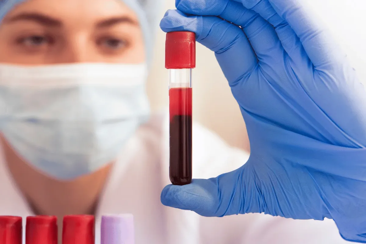 Masked laboratory clinician in blue nitrile gloves holding a capped serum tube of blood drawn for a testosterone test in Dubai