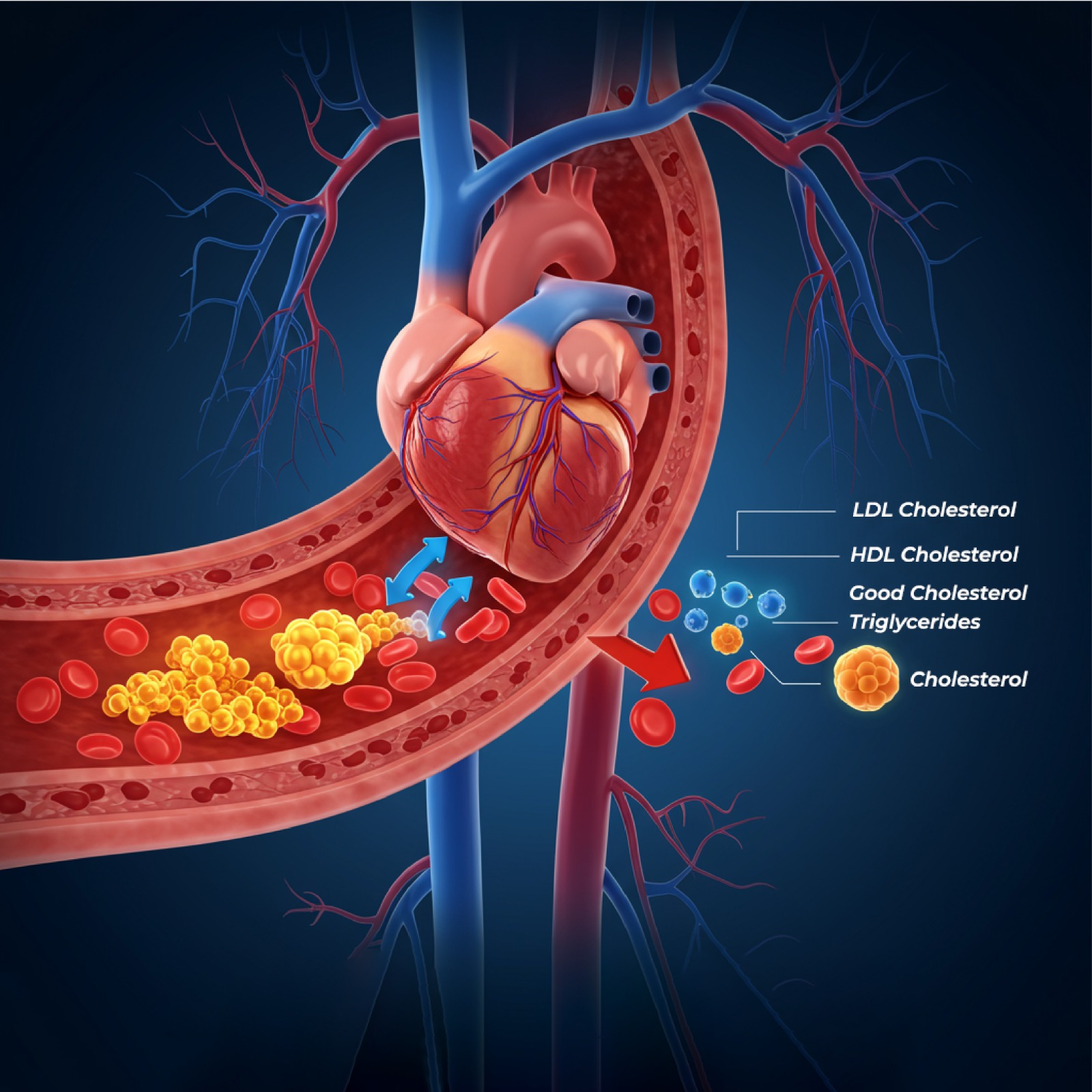 Lipid / Cholesterol Profile